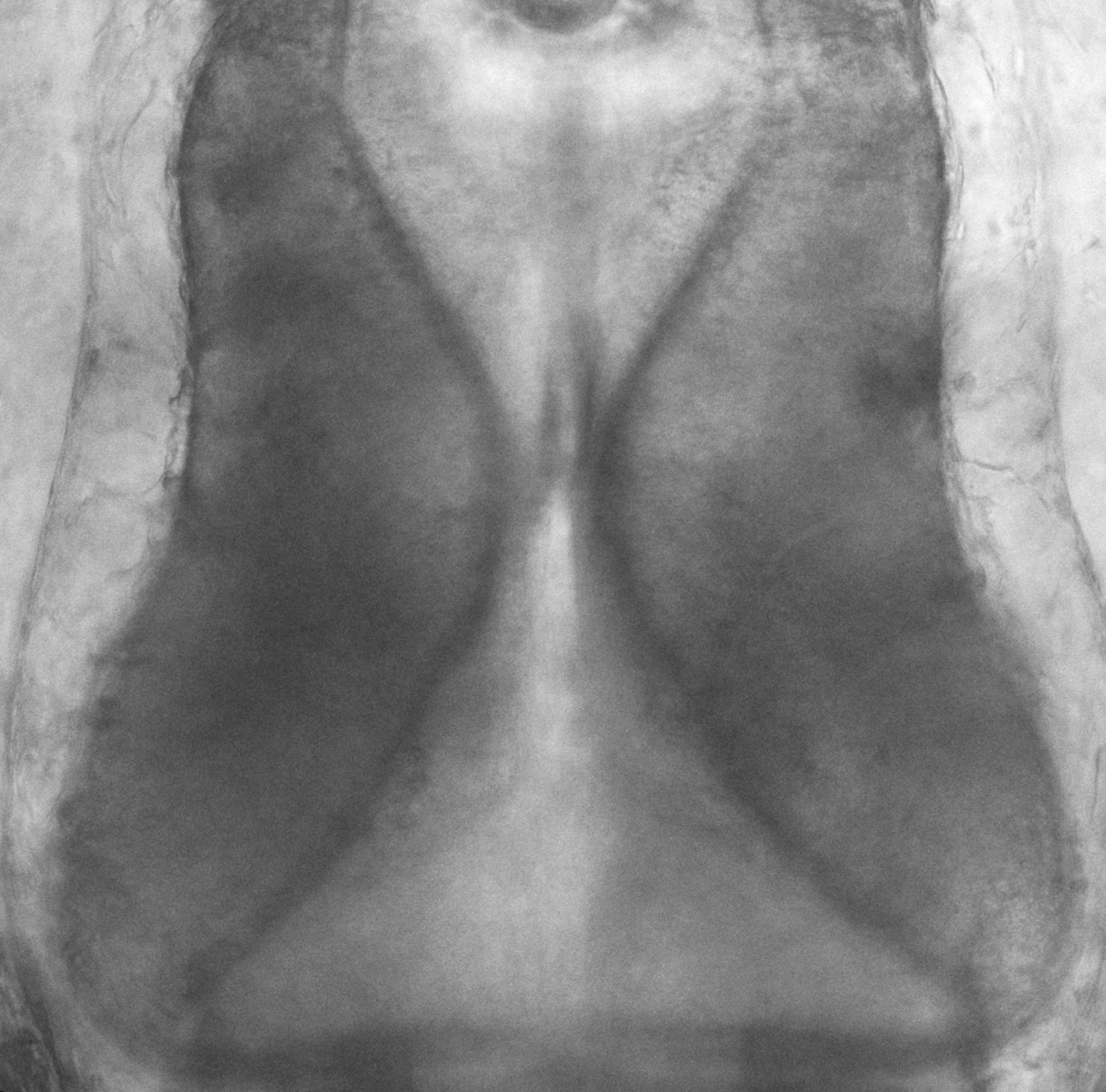 optic tectum
